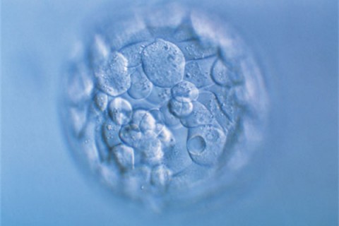 http://nanjing.quanwangkm.com/post/190.html|南京人工试管